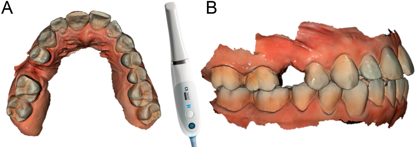 Figure1